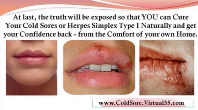 How To Get Rid Of Canker Sores On Your Tongue Fast : Herbal Breast Enhancement Advance Your Breast Size Naturally And Safely